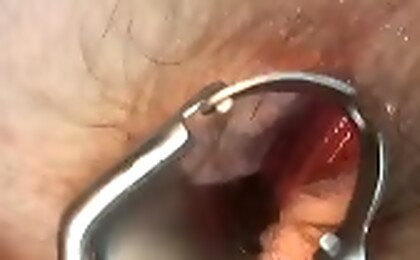 Nurse Rod Stevens Give The Anal Treatment To Hot Stud Nick